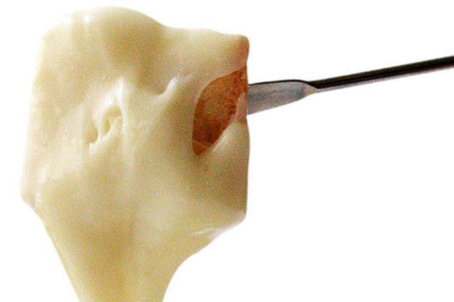 Imagem da receita